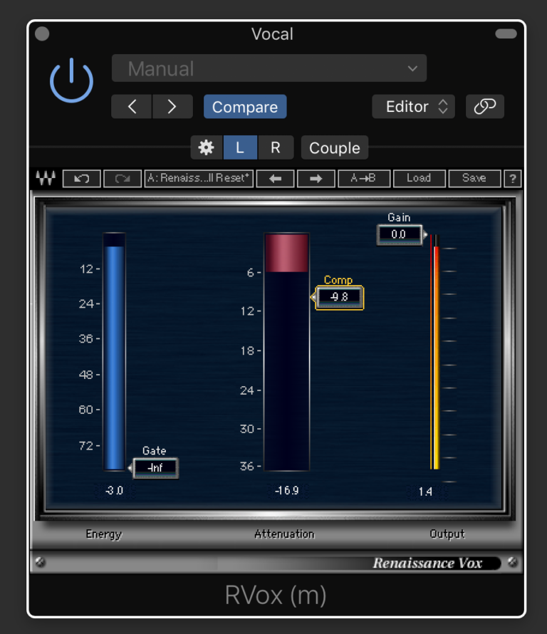Are you using this vocal compressor? It's my favorite Audio Issues